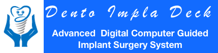 Dento Impla Deck Advanced Digital Computer Guided Same Day Dental Implants Surgery System smile in Hour India