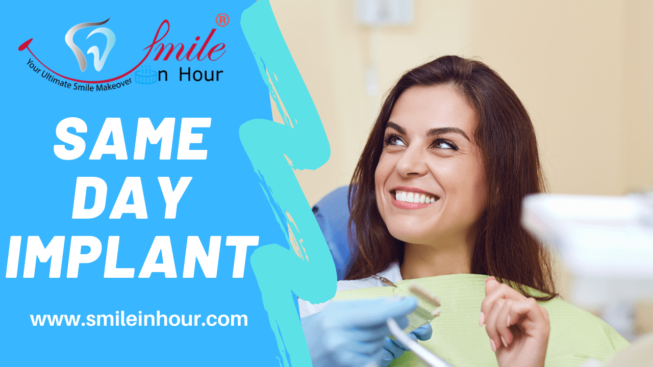 Same Day Dental Implants Cost Smile in Hour Dentist Dental Clinic India