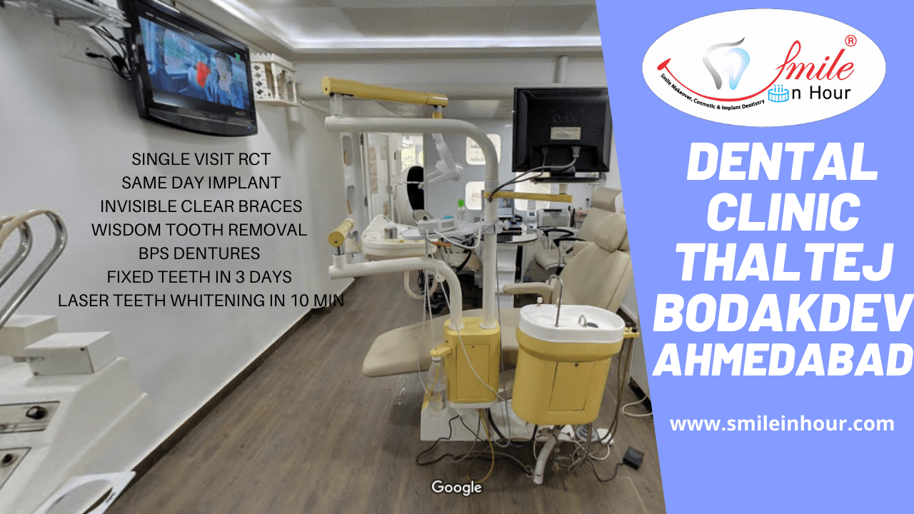 Dentist Best Dental Clinic Thaltej & Bodakdev by Smile in Hour®